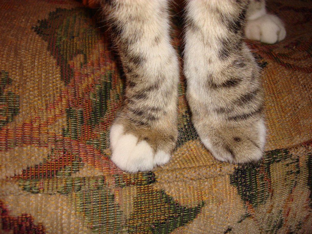 SPINDLE CELL TUMOR lipoma, Tumours… Flickr