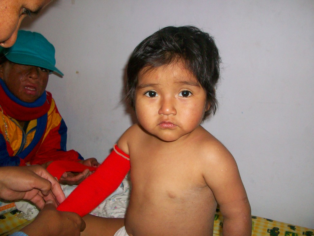 BCI July 2008 342 Burn Care International Flickr