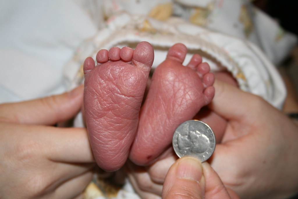 baby feet (1 day old) jencu Flickr
