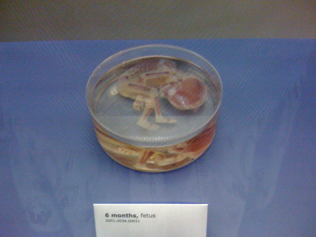 Fetus at 4 months What you don't see looking at this pictu… Flickr