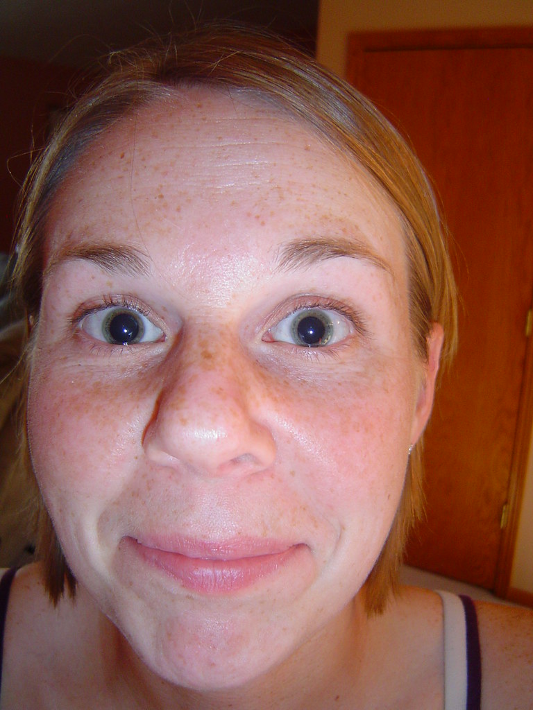 Dilated Pupils Gillian got her eyes dilated, it was very c… Ryan