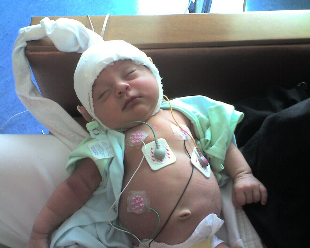 Sienna hospital stay 2 | Isai Mireles | Flickr