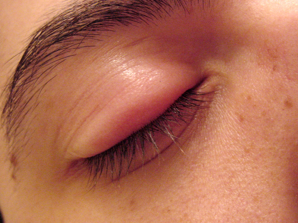 Swollen Eye Closed I woke up this morning with an extrem… Flickr