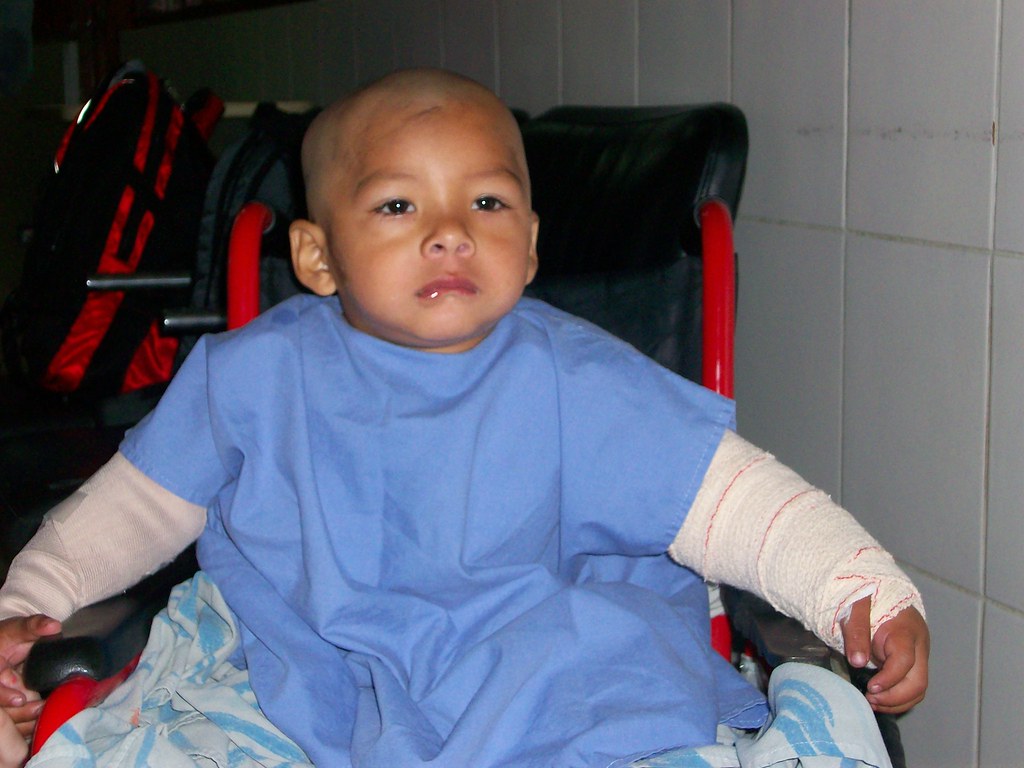 BCI July 2008 348 Burn Care International Flickr