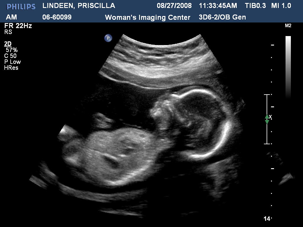 It's a boy Ultrasound 20 weeks Due date Jan. 16th Priscilla Flickr