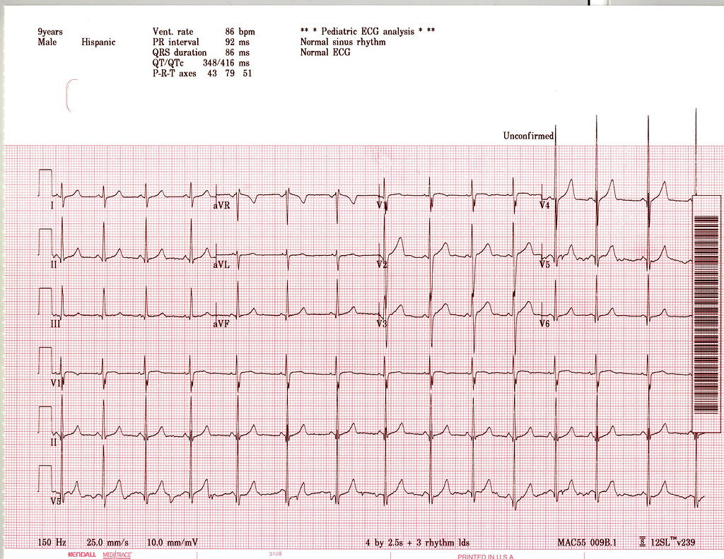 BJ154_1 Chest Pain and Palpitations gprajit Flickr
