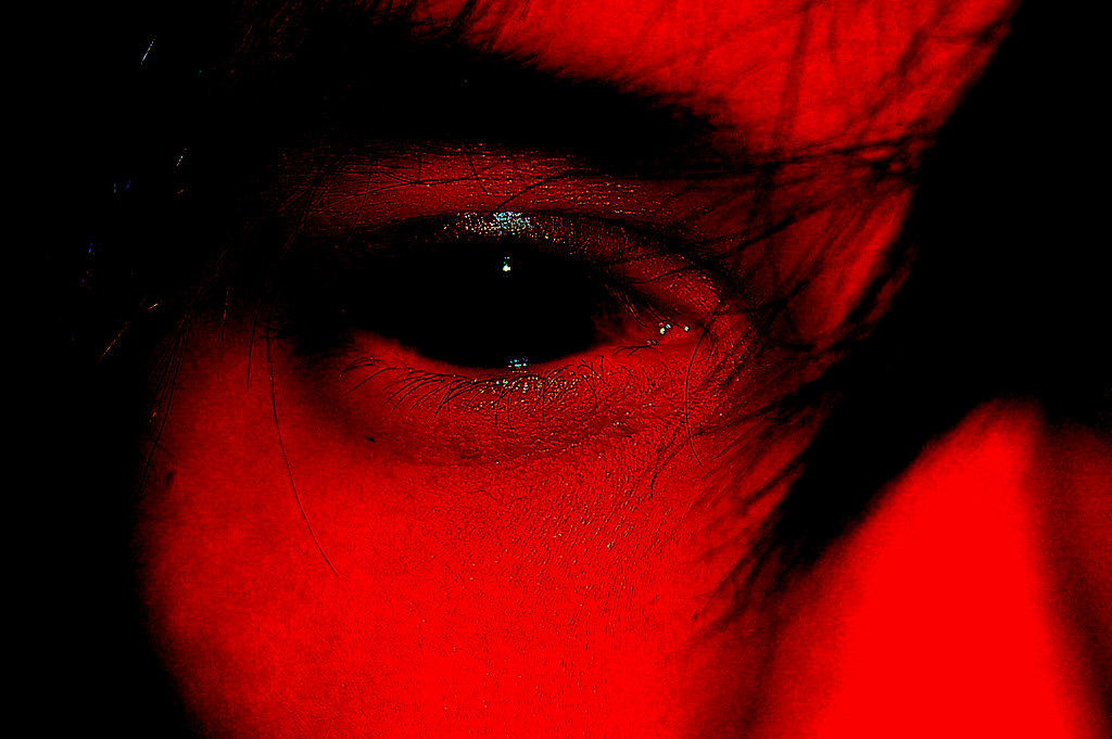Black Eye a photo on Flickriver