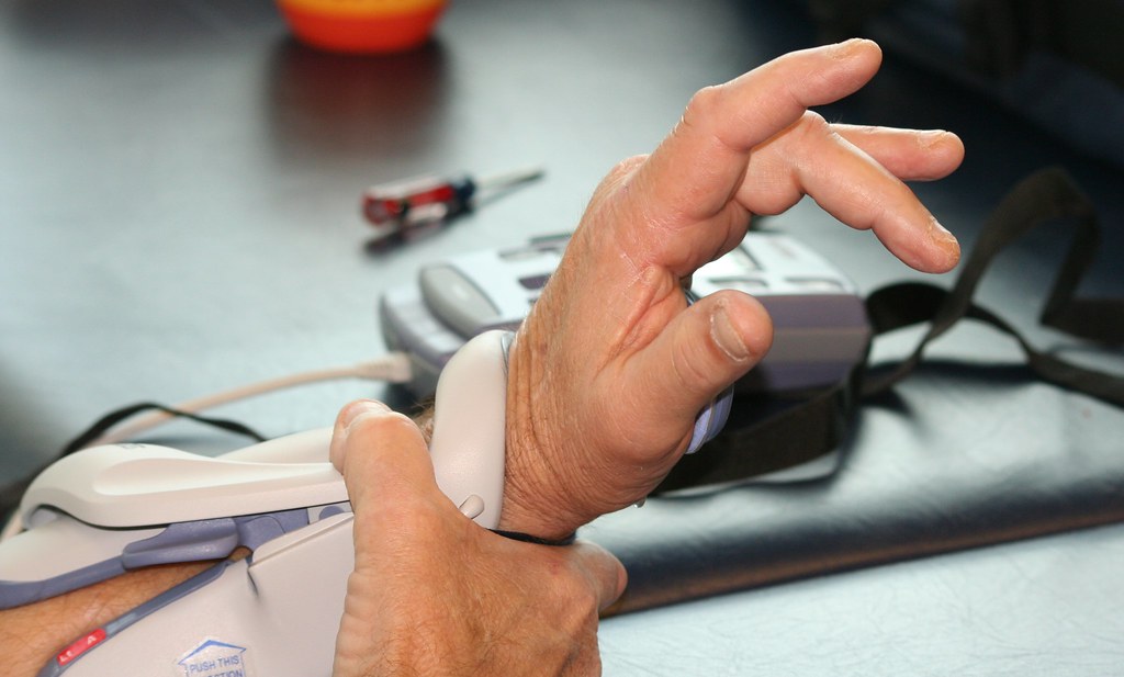 Hand manipulation 2 Physical and Occupational therapy for … Flickr