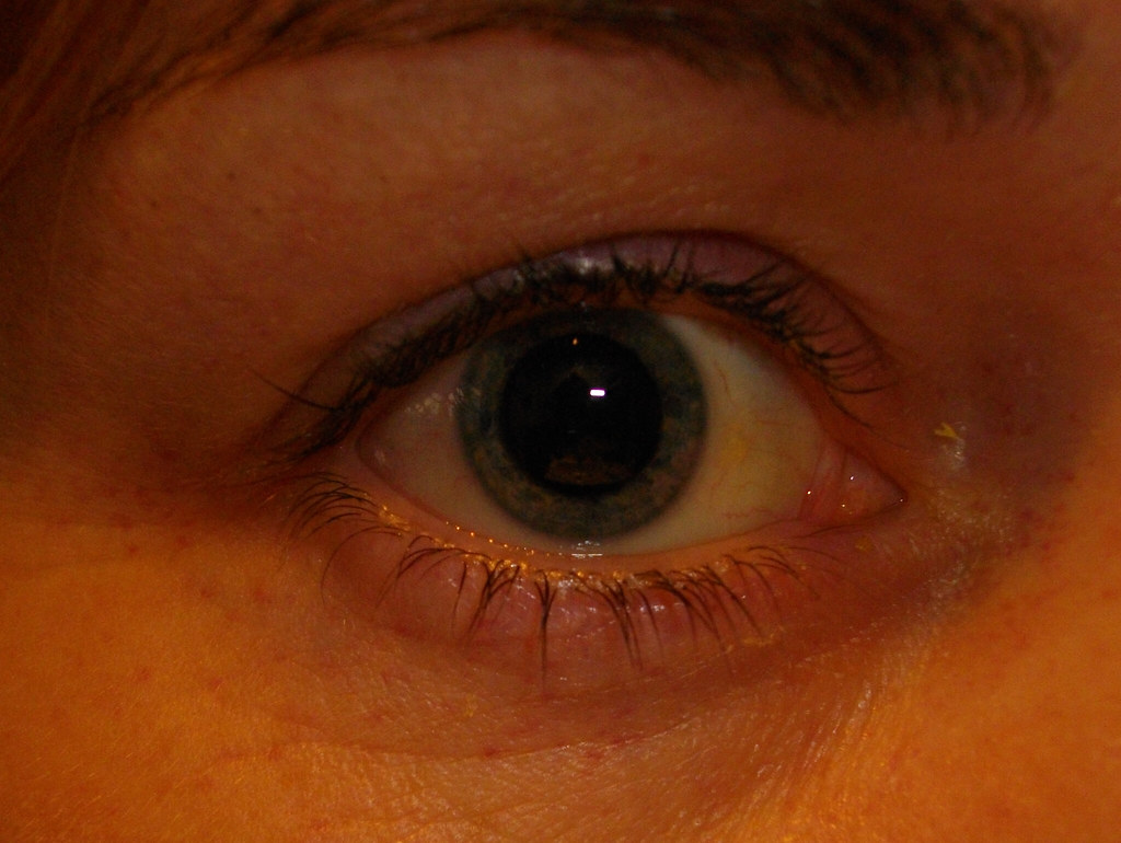 dilated pupil Beth Flickr