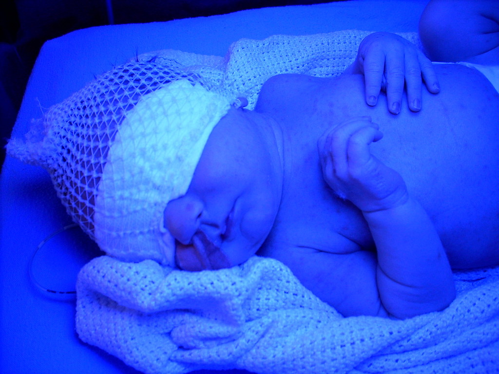Phototherapy In the Neonatal Unit, but in a nicer cot. Onl… Flickr