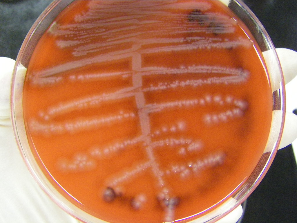 urine culture (bap) looks like E. coli. smells like E. col… Flickr