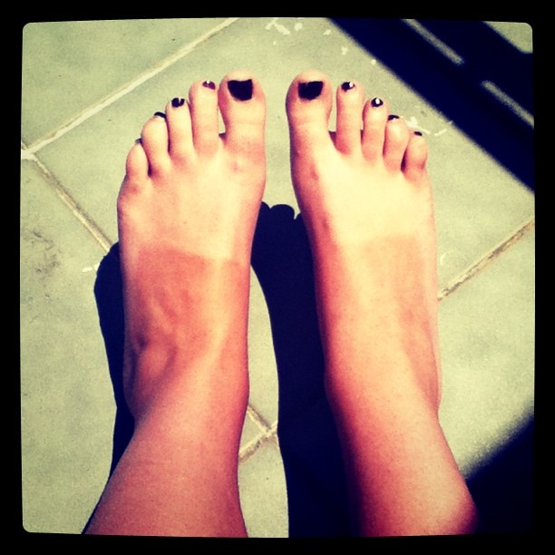Definitely the most ridiculous tan lines I've ever had thi… Flickr
