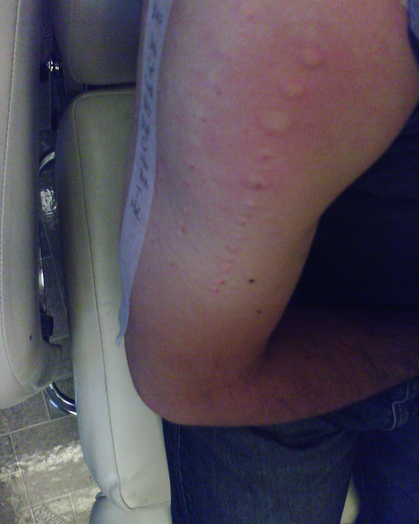 dust mites and cats apparently i'm allergic to both types … Flickr