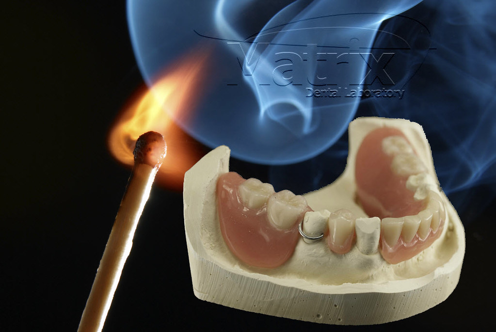 Treatment Provisional Matrix Dental Laboratory is partnere… Flickr