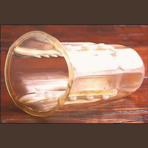 Ehlers, of South Africa (the rape capital of the w