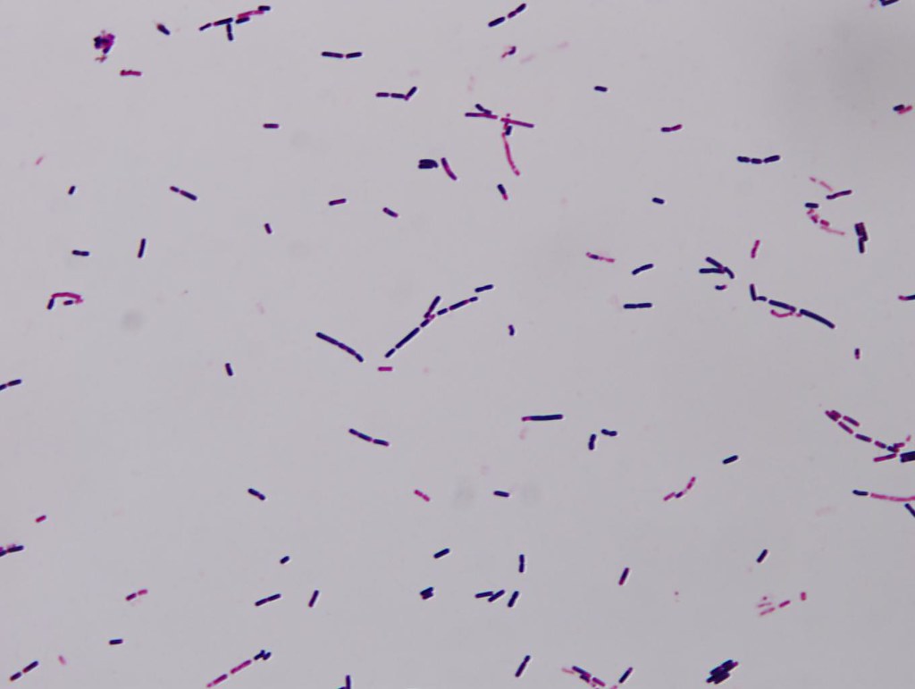 Gram stain of Bacillus cereus Gram stain of Bacillus cereu… Flickr