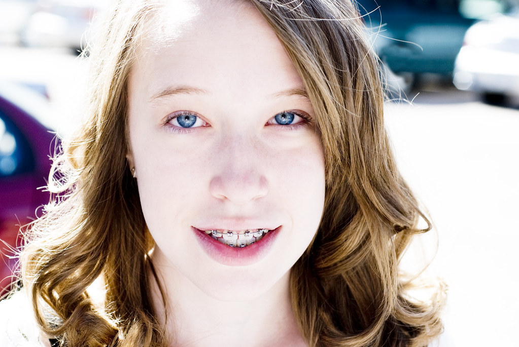 14yearold teen with braces Section 45 Flickr