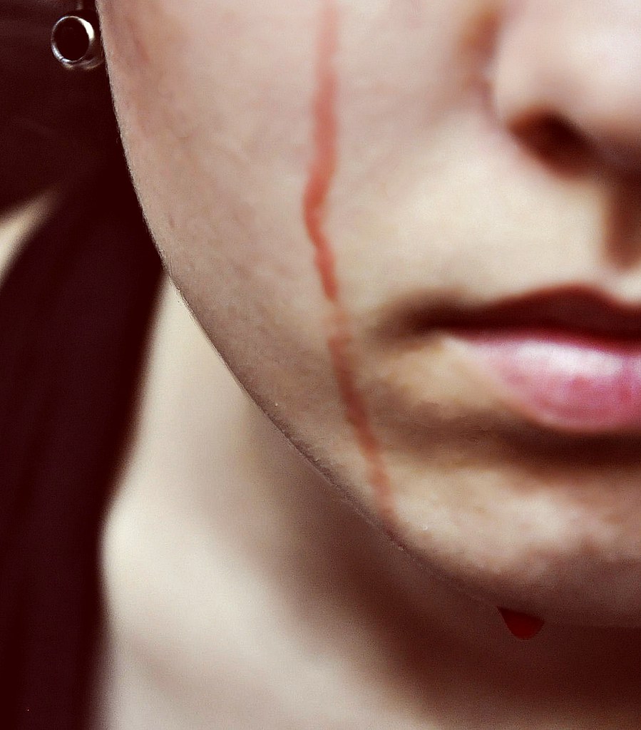 Blood & Tears. Sono solo lacrime di sangue ciò che resta, … Flickr