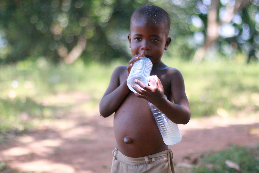 kwashiorkor the swollen belly is called kwashiorkor. it's … Flickr