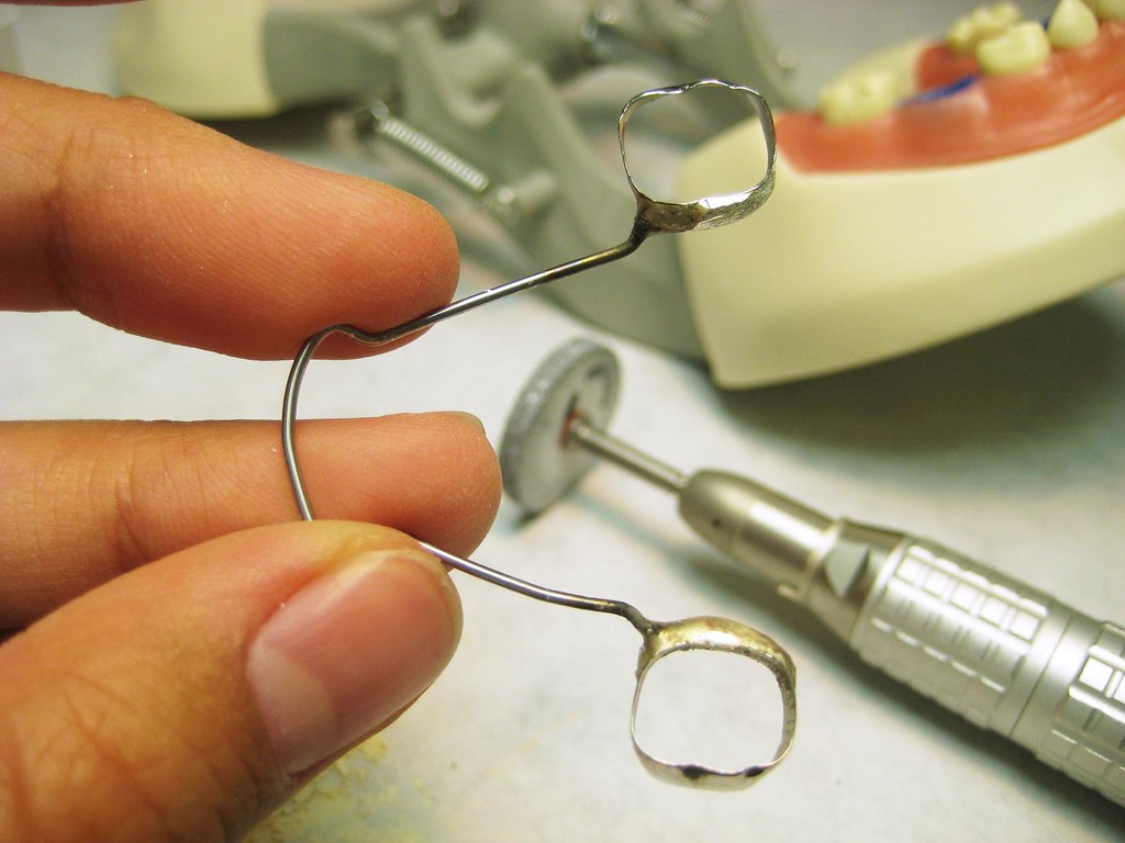 mandibular lingual arch SM, pt.5 a pediatric lab project. … Flickr