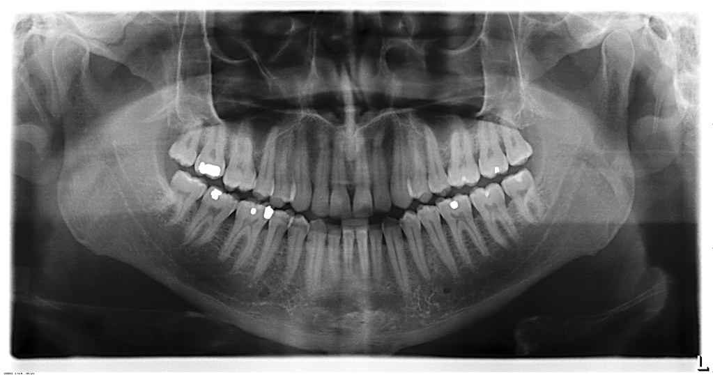 Crazy digital dental xray, London, UK.jpg LEAD Technologi… Flickr