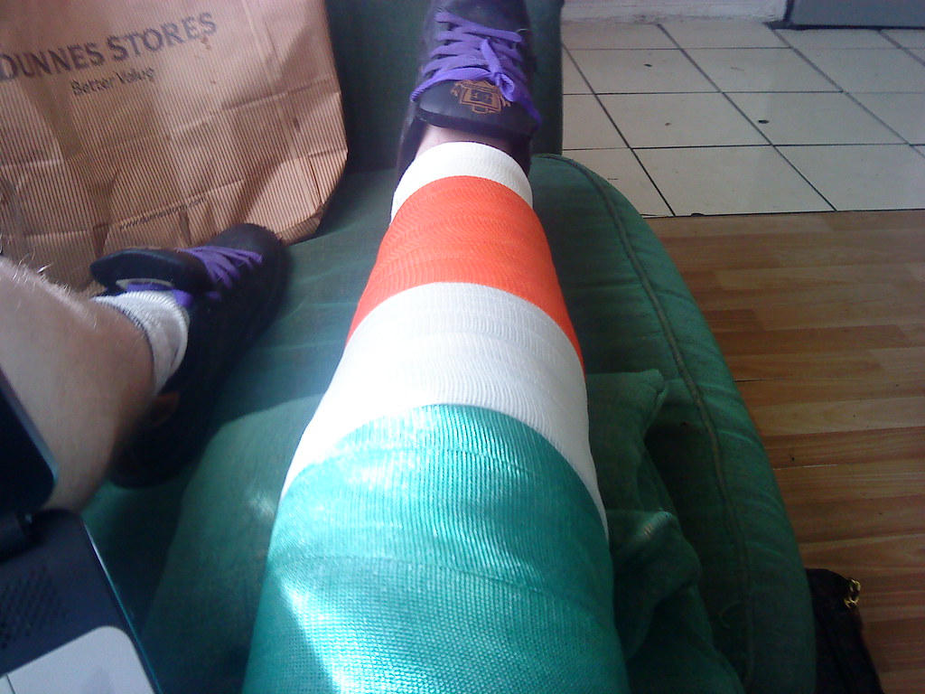 my new cast much better then dat smelly blue 1 i hadhaha i… Flickr