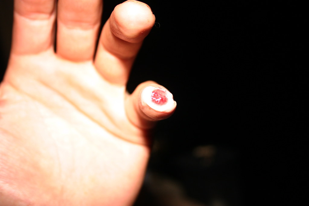 Flickriver Photoset 'Finger Wound' by Russell Swanker