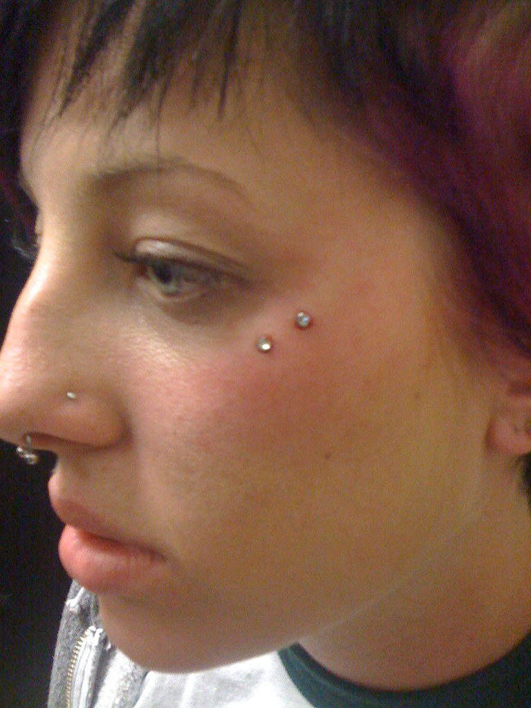 Dermal Anchor A microdermal is a form of pocketing which g… Flickr