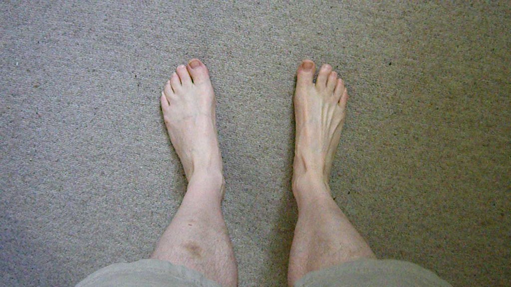 Weird foot problem Can't lift or move my left foot properl… Flickr