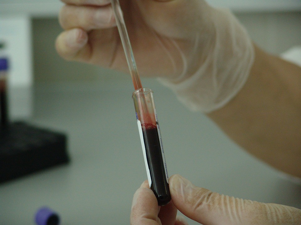 blood testing labs NJ NJ Doctors Urgent Care offers diagno… Flickr