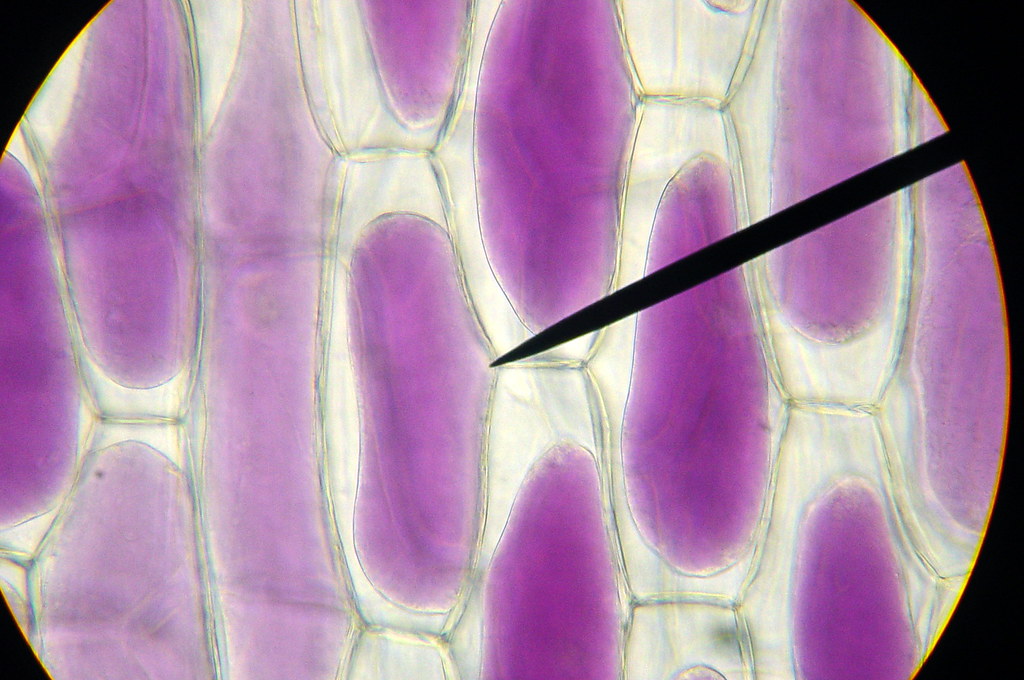 Onion Cells Ditilled Water After Salt Solution biopocketgopher Flickr