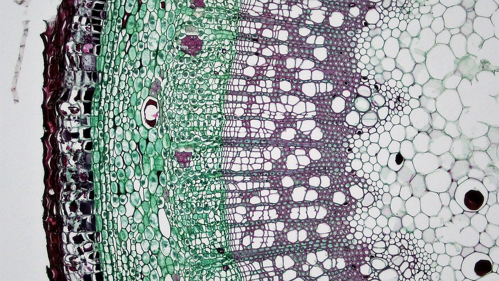 Woody Dicot Stem Ray System in Sambucus cross section Sa… Flickr