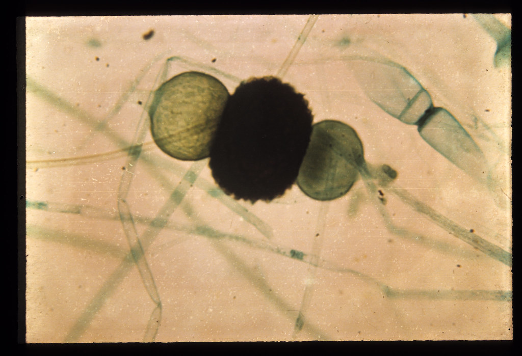 fungus zygospore old laboratory macro and micro photograph… Flickr
