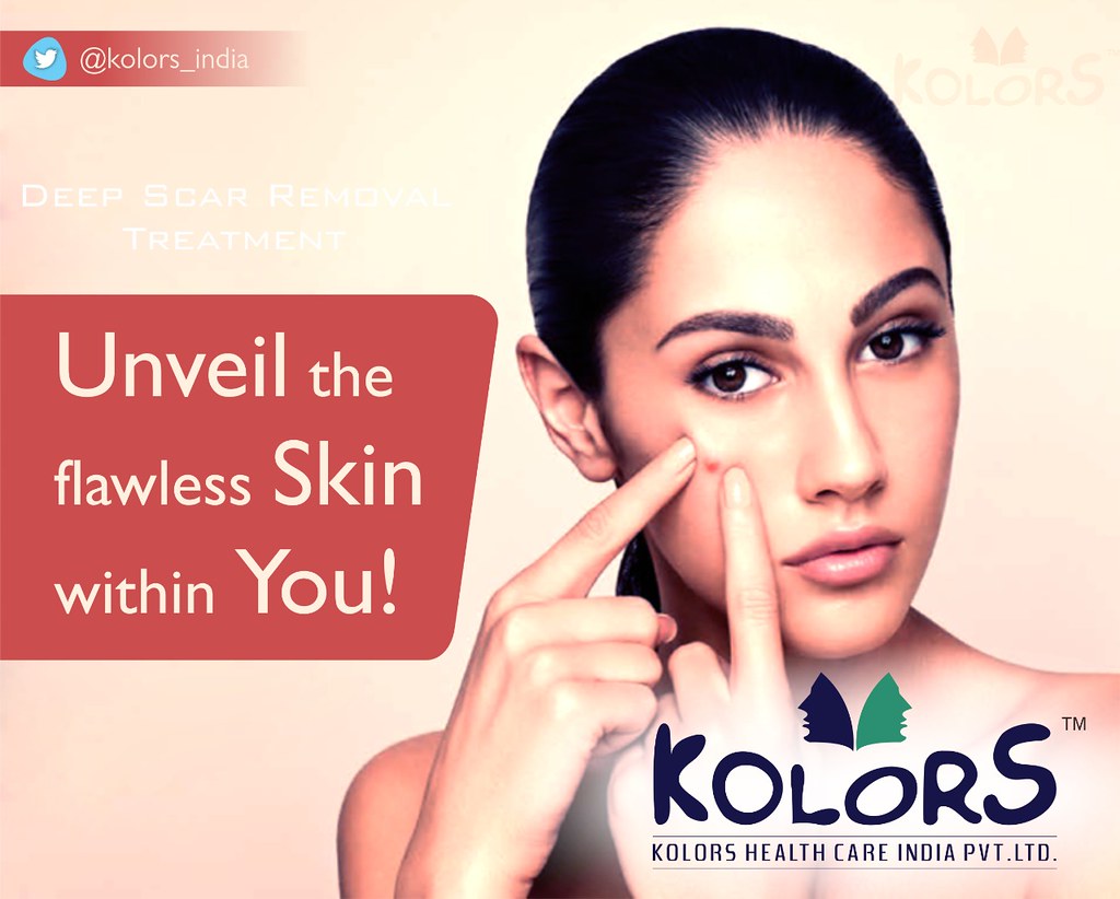 deep_scar_Treatment Now, get an excellent Scar Removal Tre… Flickr
