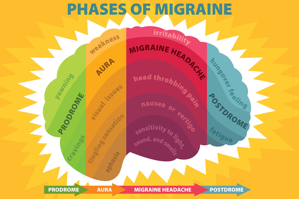 MIGRAINE causes and factors triggering migraine