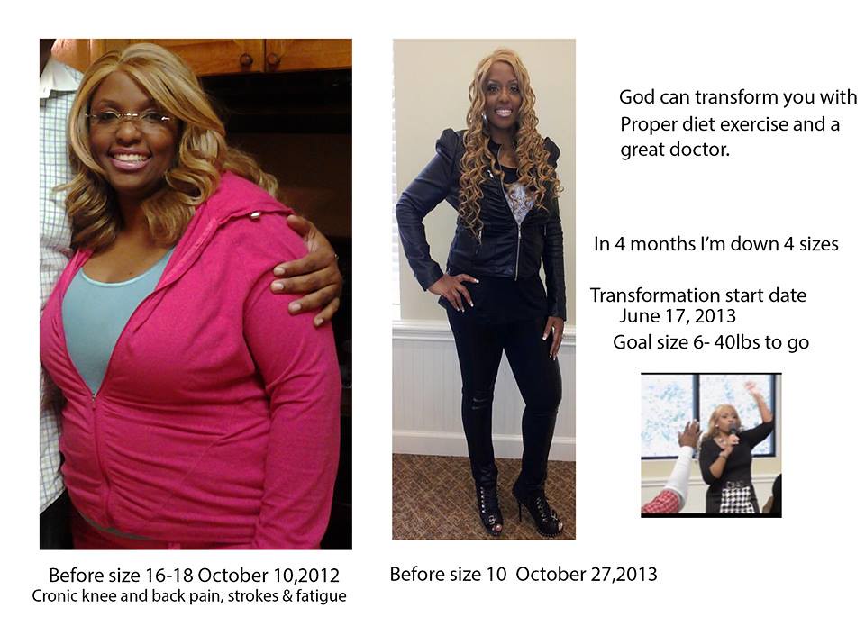 Tijuana Mexico Weight Loss Surgery Reviews ALO Bariatrics … Flickr