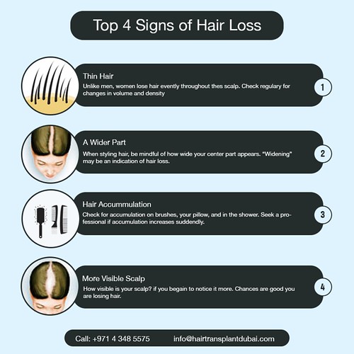 4 Signs of Hair Loss Signs of Hair Loss thehairtransplan… Flickr
