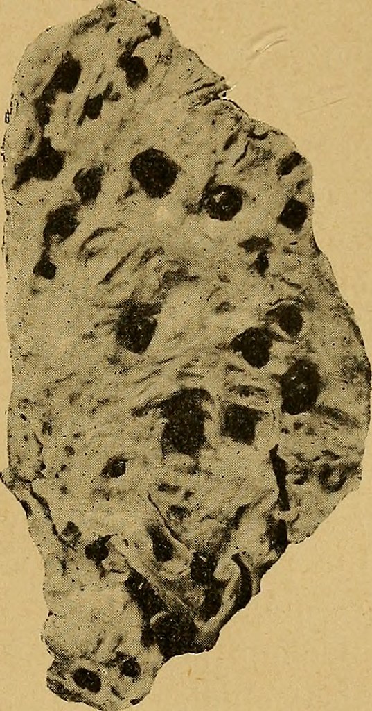 Image from page 562 of "Archives de parasitologie" (19051