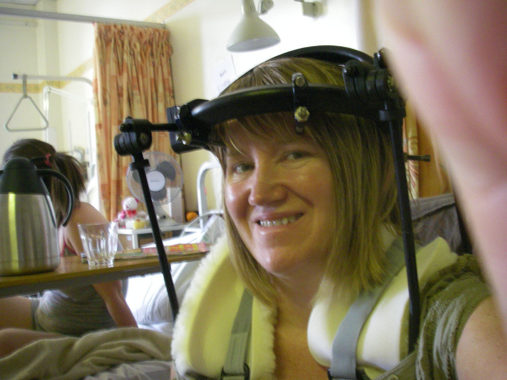 halo001 Halo Braces and Other Spinal Orthotics plasterman632 Flickr