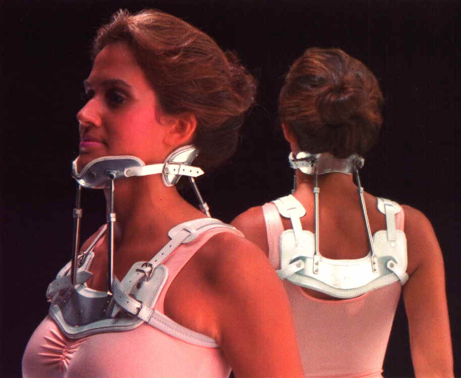 Halo and Other Spinal Braces plasterman632 Flickr