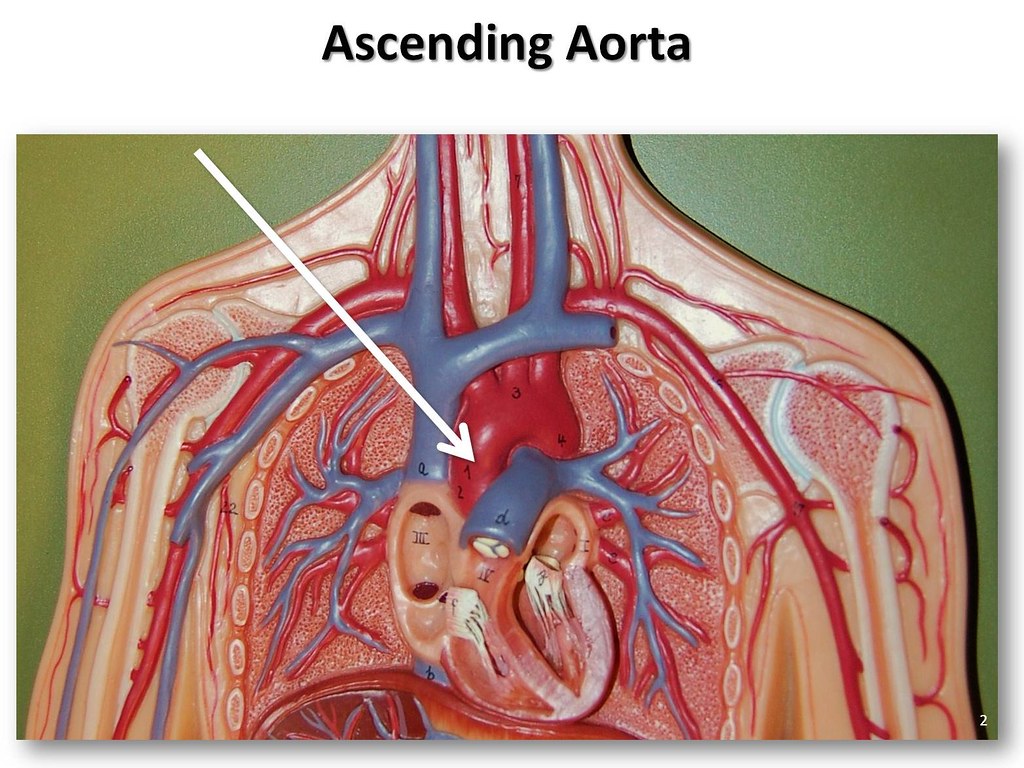 Ascending Aorta Anatomy Anatomical Charts & Posters