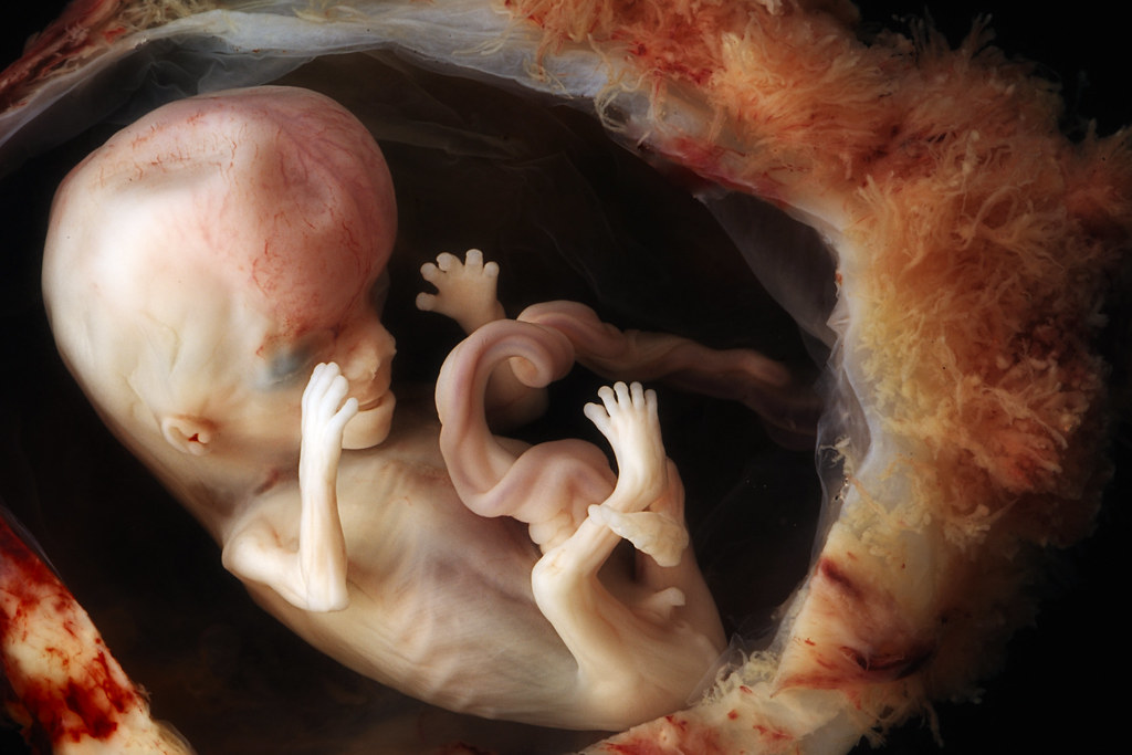 Fetus 10 12 weeks CR 3.6cm. For perspective the foot