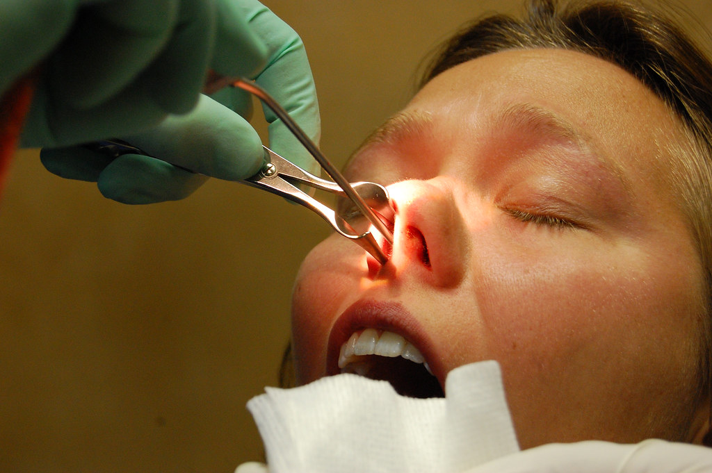 JoAnn's Septoplasty, Turbinate Reduction and Sinus Spelunk… Flickr