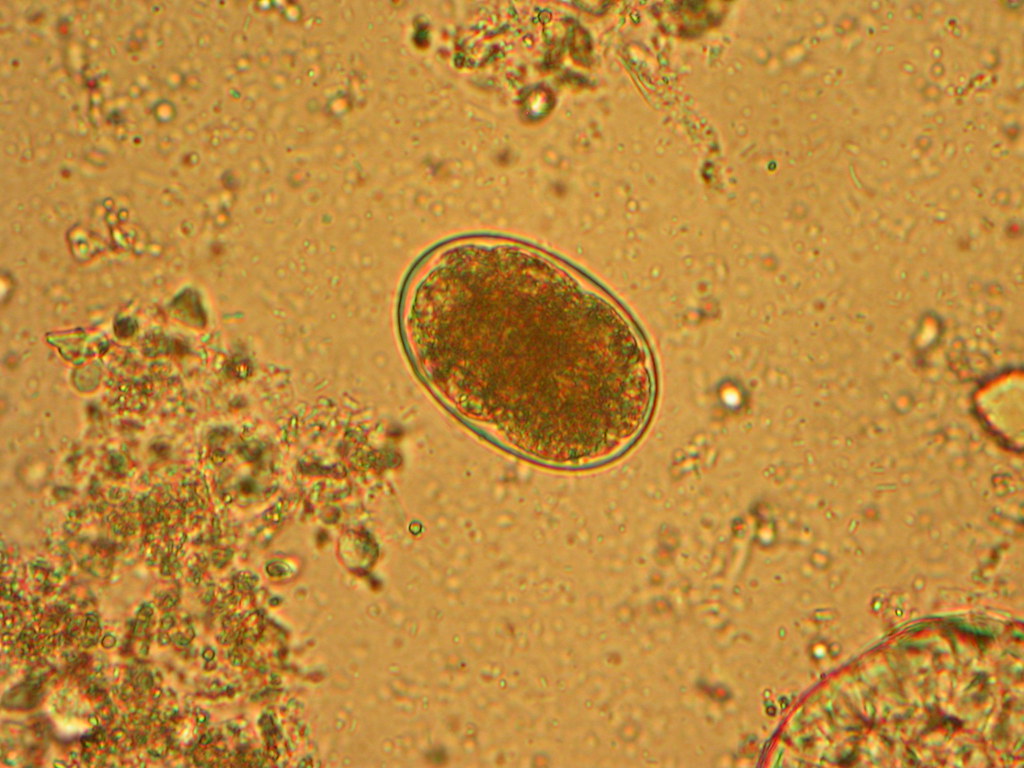 Hookworm ova Nathan Reading Flickr