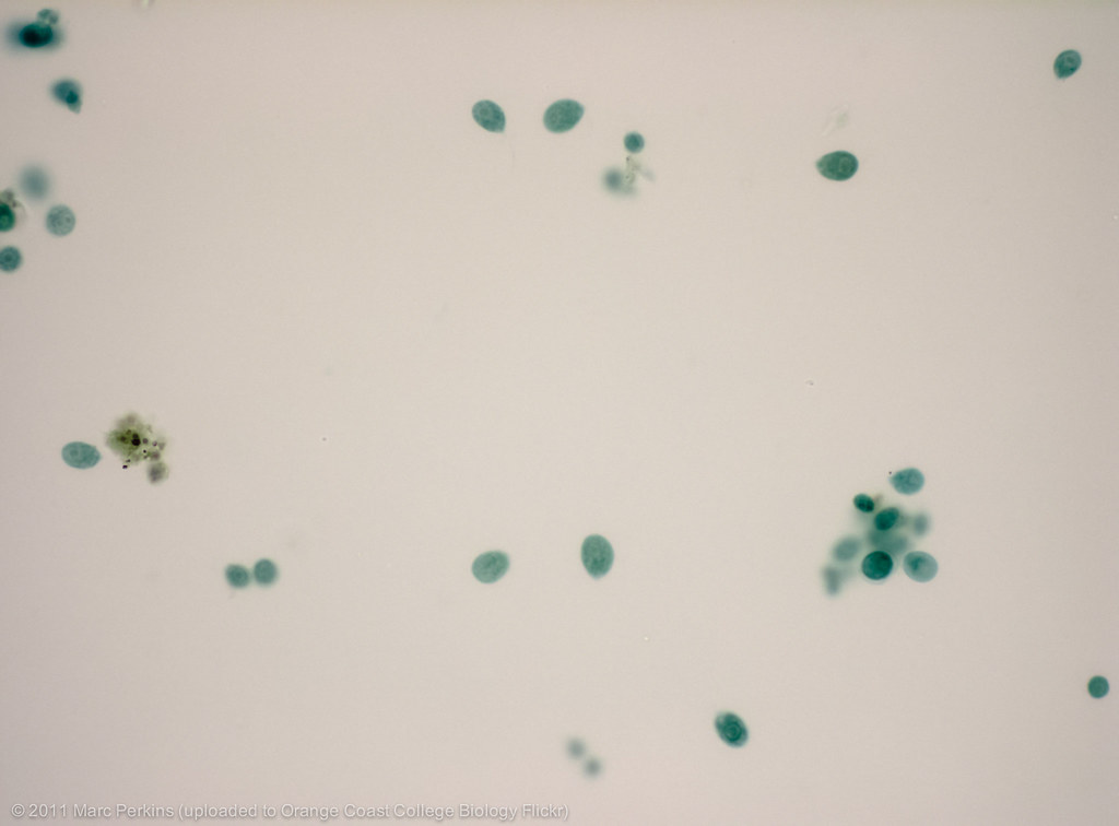 Preserved Chlamydomonas at 400x A slide of preserved Chlam… Flickr