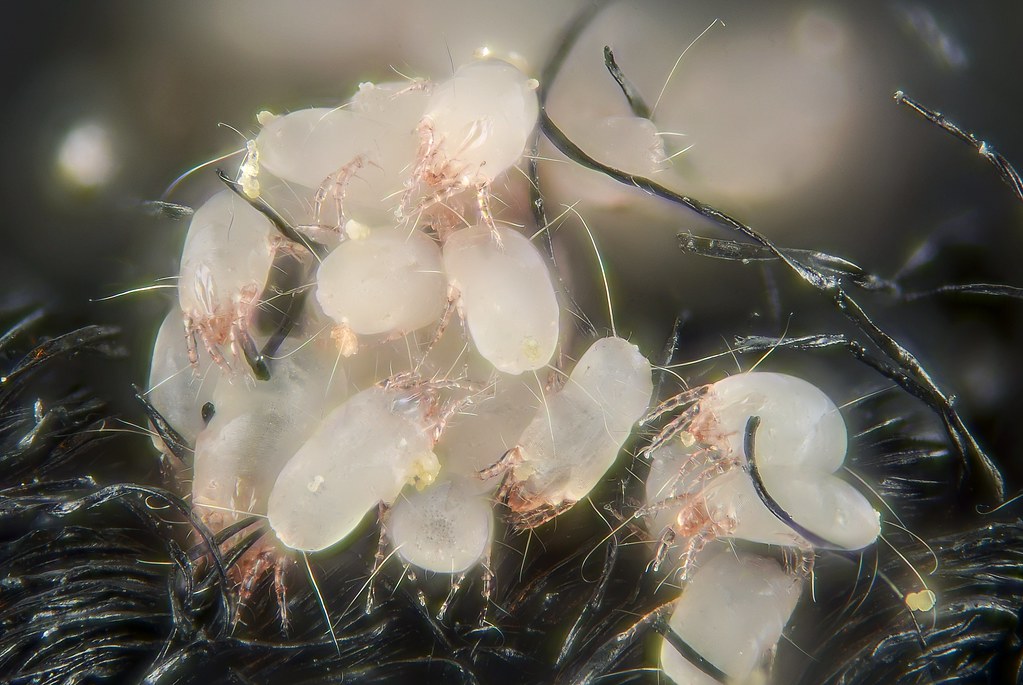 House dust mites House dust mites (Dermatophagoides pteron… Flickr