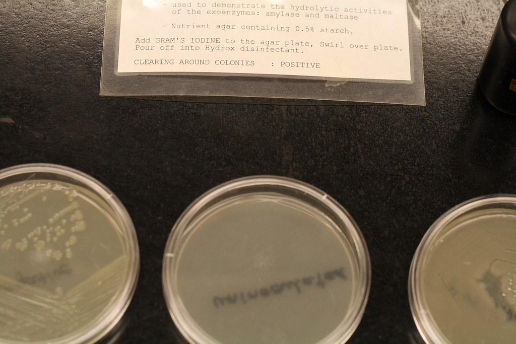 Tributyrin Agar Test for Lipase 3 blain_therapist Flickr