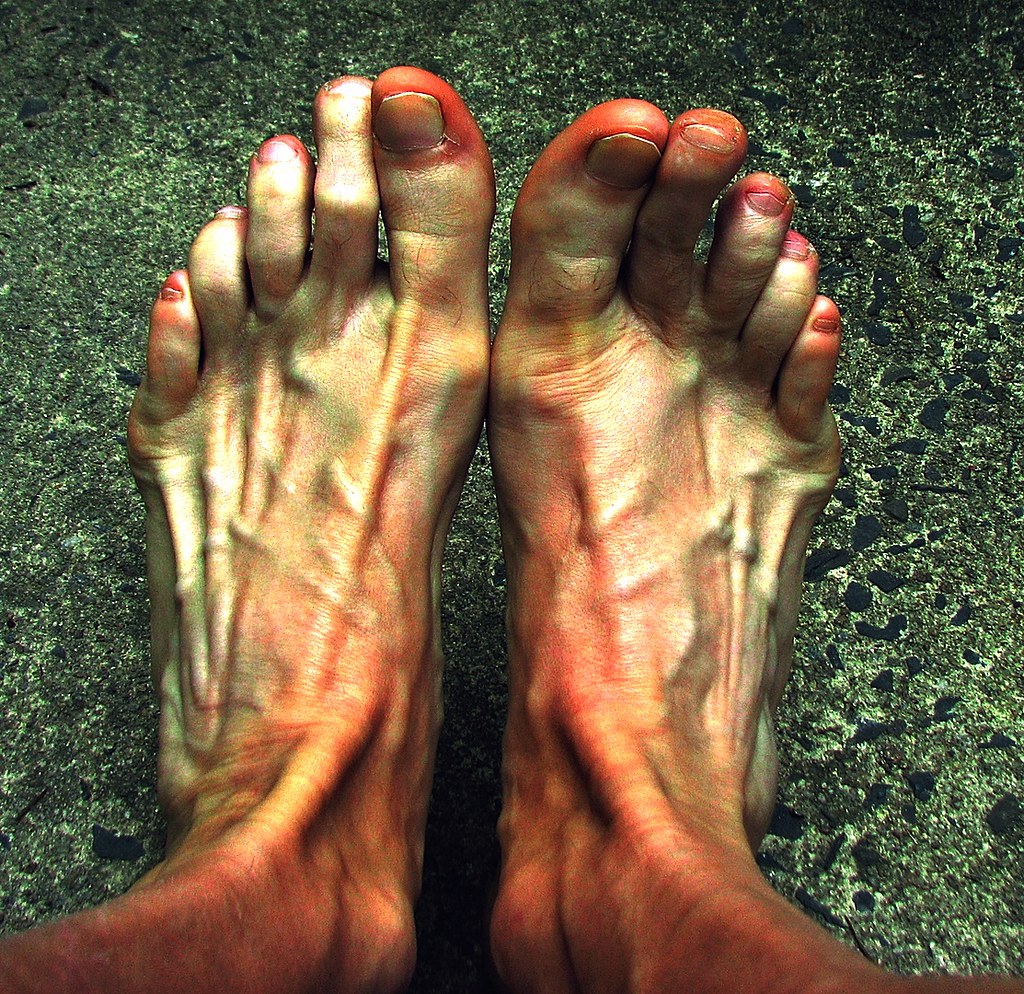 Hot Feet Illustrate heat in one of its many forms in a pho… Flickr
