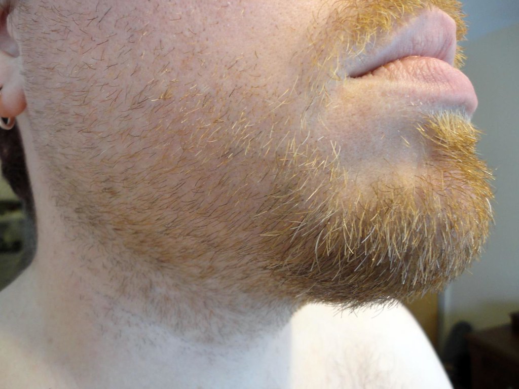 White hairs in my beard from either aging or spreading vit… Flickr