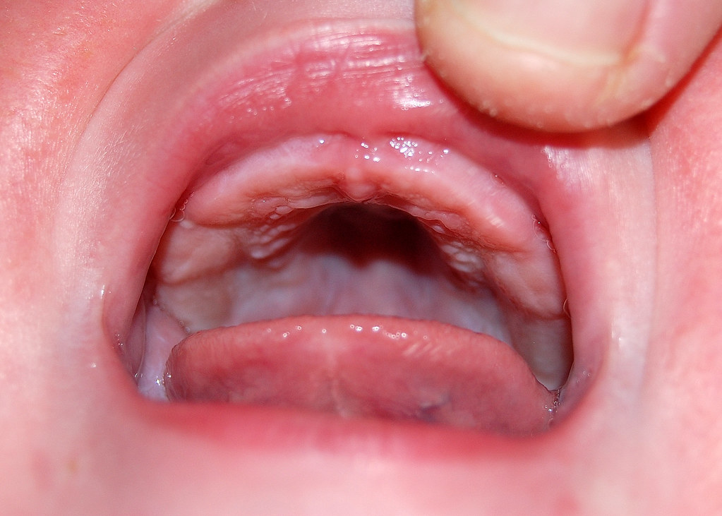 A cut tie Ernest does not like us to pull up his top lip a… Flickr